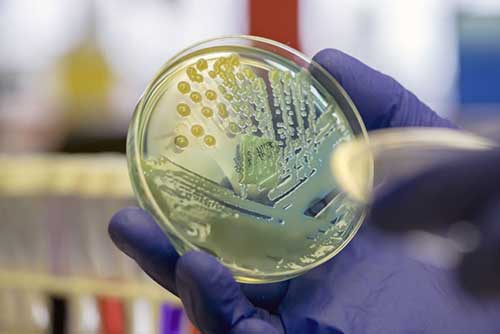 Biotecnologia multiplica em até 18 vezes as cepas bioativas do solo